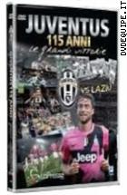 Juventus 115 Anni - Le Grandi Vittorie - Juventus Vs. Lazio